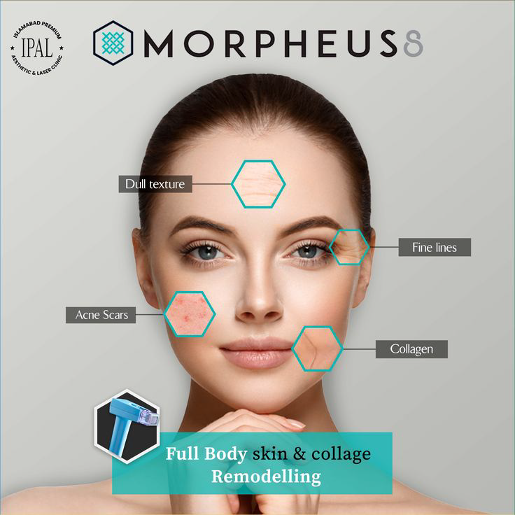 Morpheus8