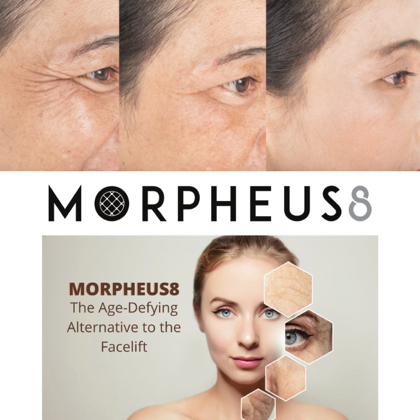 Morpheus8